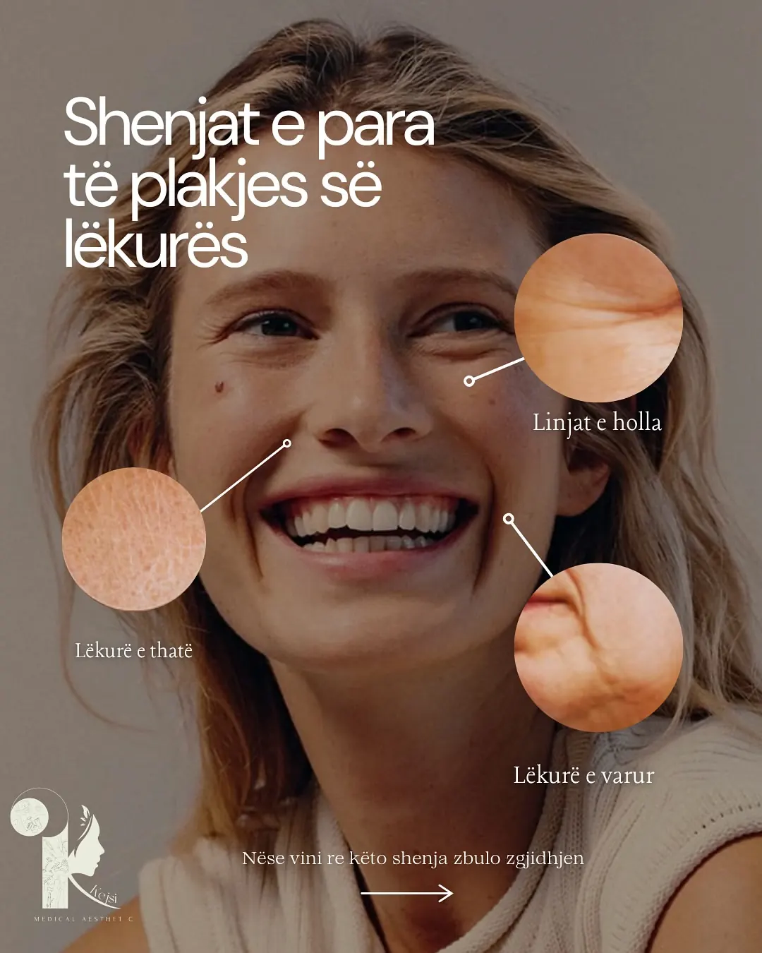 Kejsi Medical Aesthetic post on the first signs of skin ageing, three circular close-ups annotating fine lines, dryness and laxity.