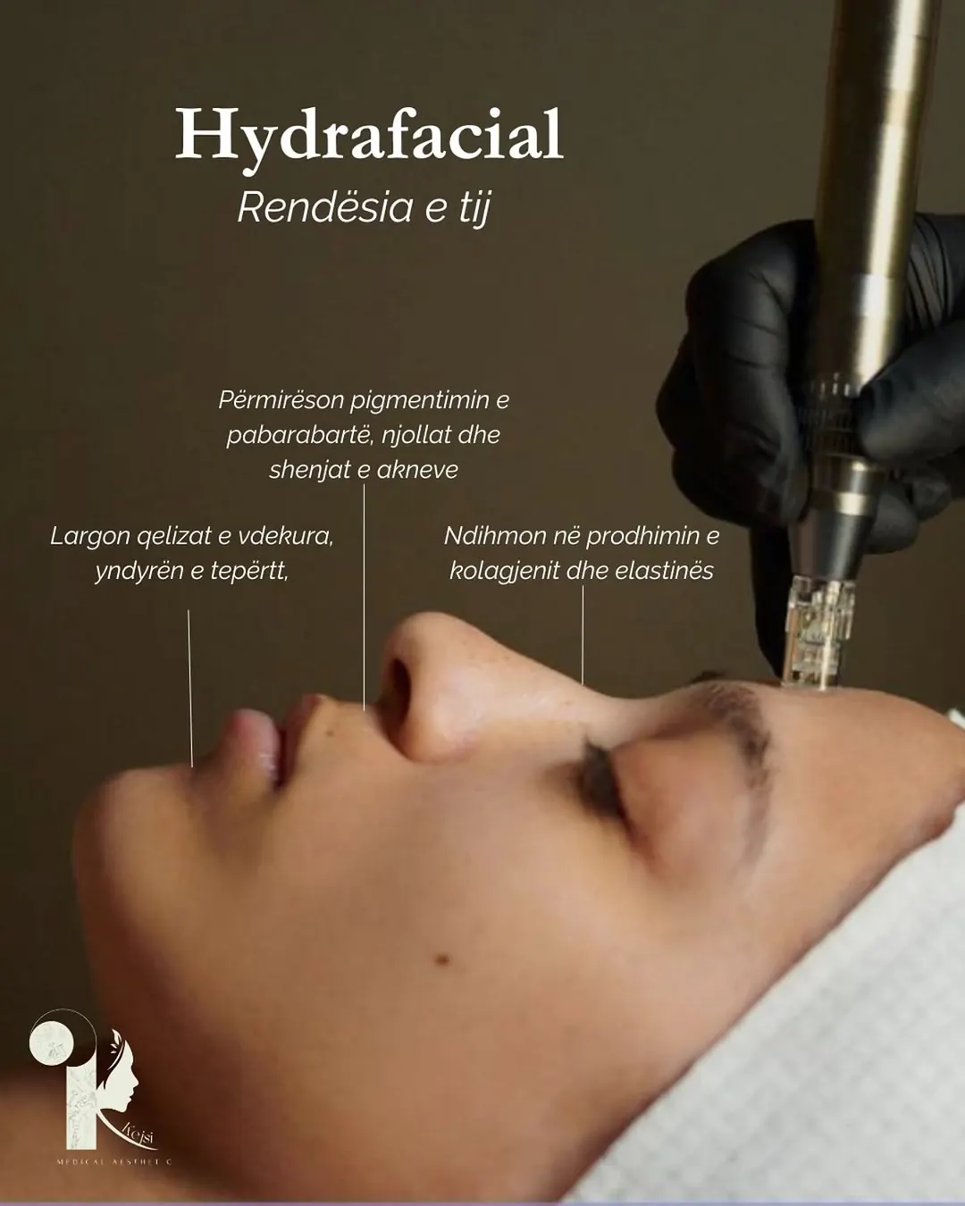 Kejsi Medical Aesthetic Hydrafacial post — a gloved hand guiding the device across a client’s cheek, benefits labelled around her.